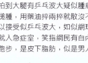 周润发否认患肿瘤：大家看到的那些小肉球其实是皮下脂肪